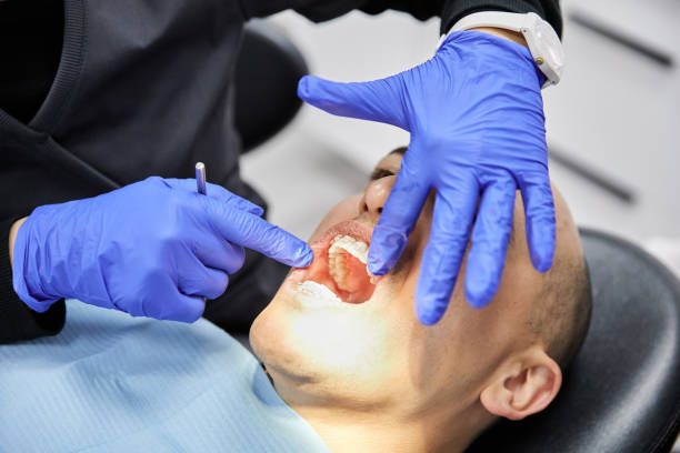 Best Emergency Tooth Extraction in Luray, VA