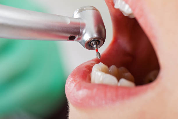 Best Weekend Emergency Dentist in Luray, VA